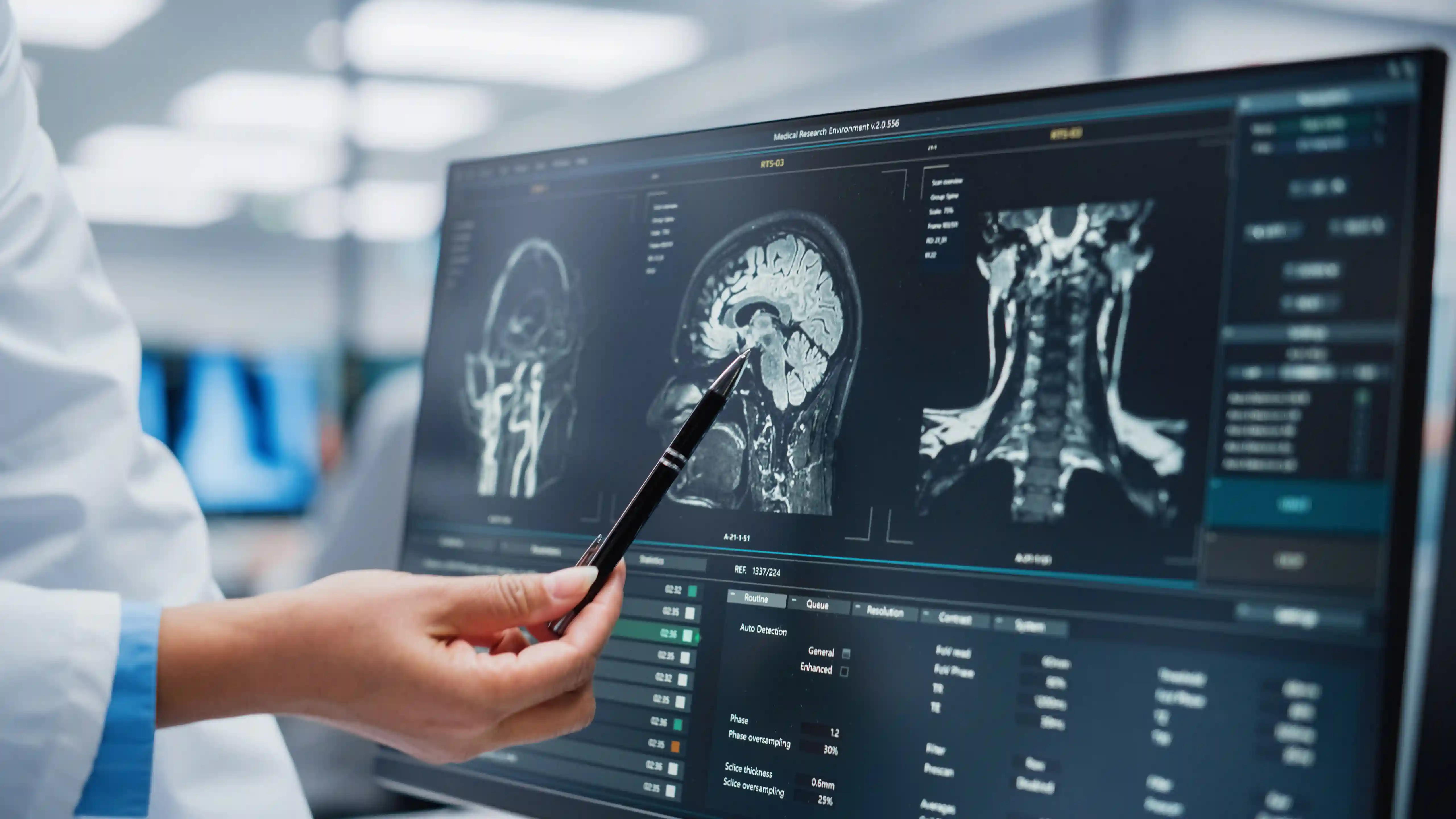 Médico apontando imagens de ressonância magnética na tela para laudo